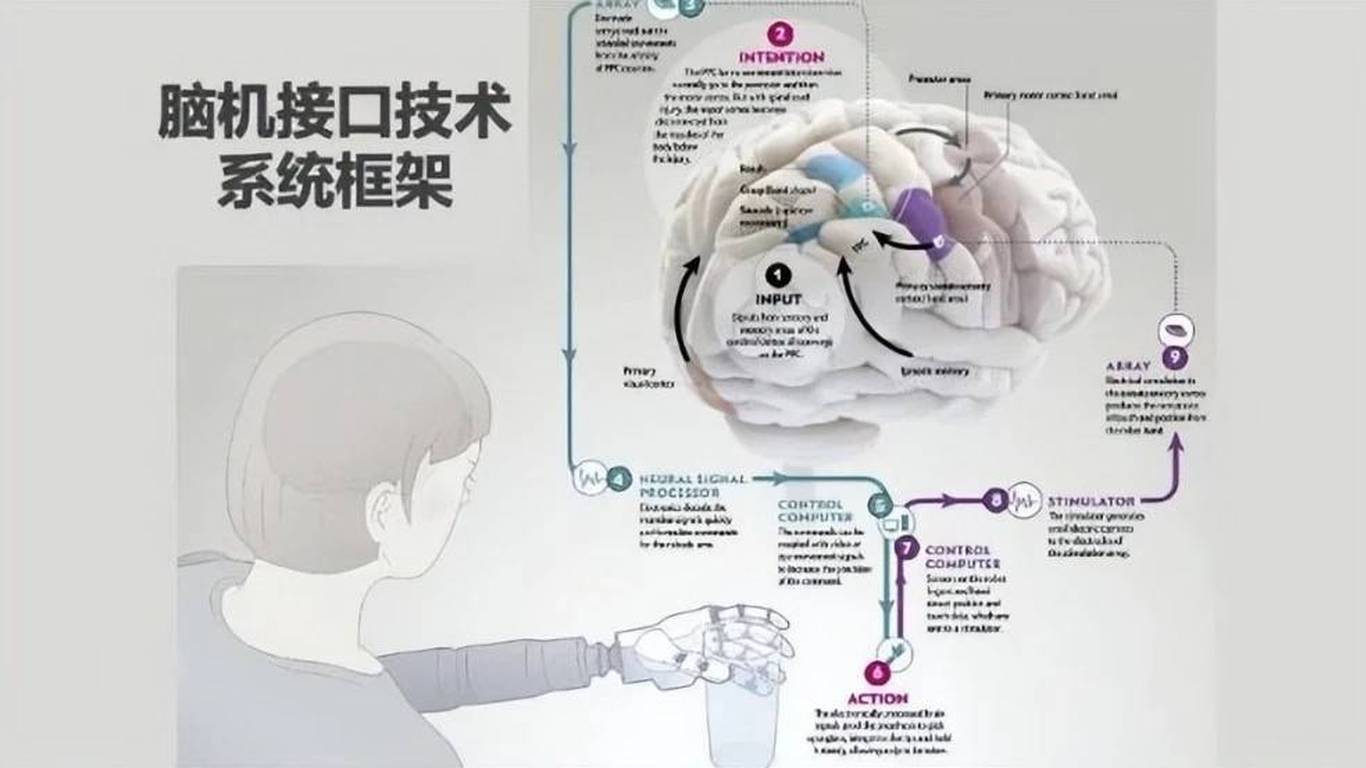 脑机接口进医保，医院挤满想试的人